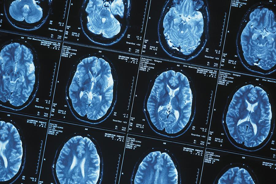 Brain scans collection